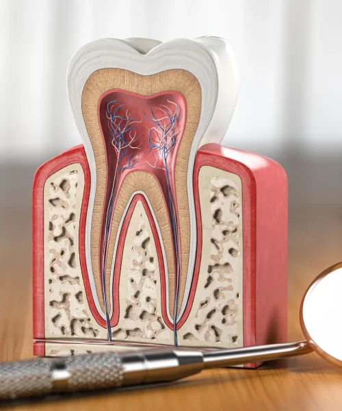 endodontia endodontia